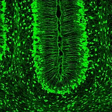 A radial glial cell